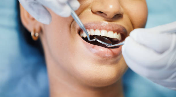 Best Emergency Wisdom Teeth Removal in Hlcrest, IL